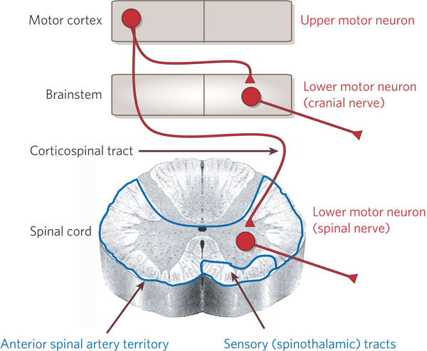 MOTOR NEURON DISEASE