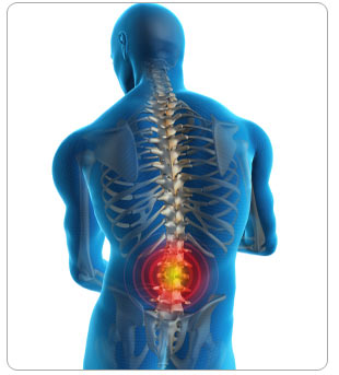SPINAL CORD INJURY