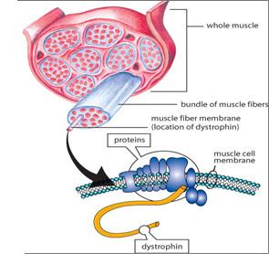 muscular dystrophy